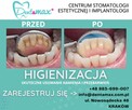 Bezpłatna konsultacja - Dentamax Nowosądecka 46 Kraków - 3